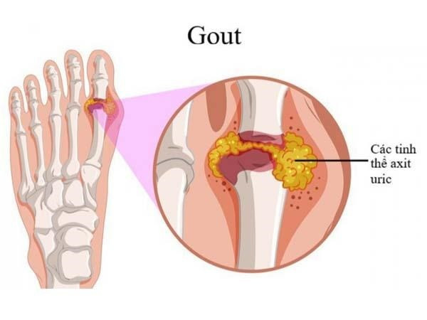 gut11.jpg