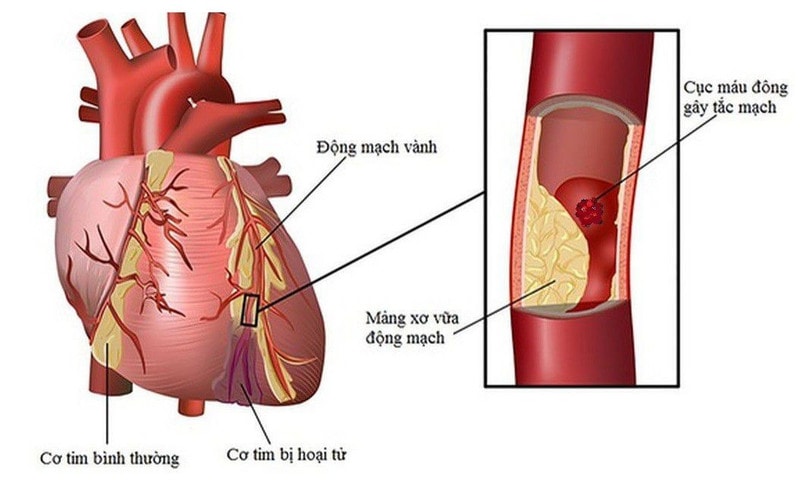 Vỏ chanh là một thành phần tiềm năng trong chế độ ăn tốt cho tim mạch. Vỏ chanh là một thành phần tiềm năng trong chế độ ăn tốt cho tim mạch.