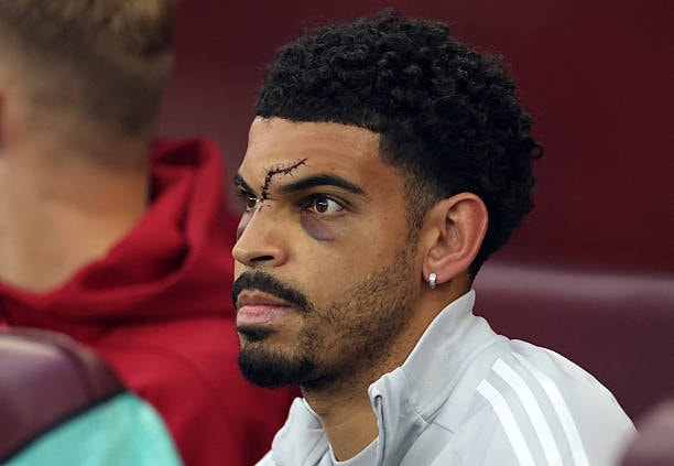 Vắng Gibbs-White là mất mát to lớn của Nottingham.