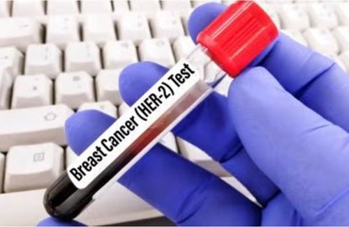 Thuốc giredestrant của Roche trong thử nghiệm lâm sàng điều trị ung thư vú