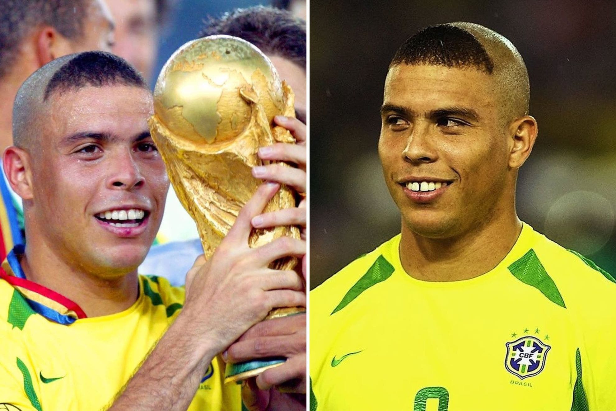 Diện mạo kỳ quặc giúp Ronaldo giải tỏa áp lực chấn thương