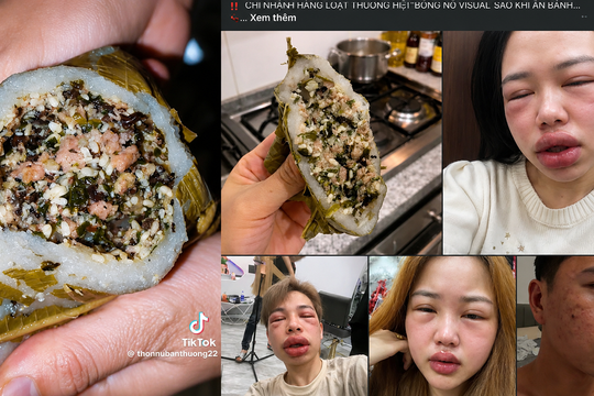 Câu view bằng đồ ăn lạ: Đánh đổi sức khỏe lấy lượt xem