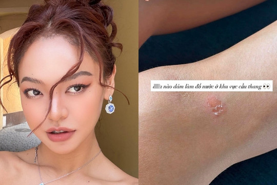 Mai Ngô gặp sự cố chấn thương ngay trước phần thi Top Model tại Miss Supranational 2026