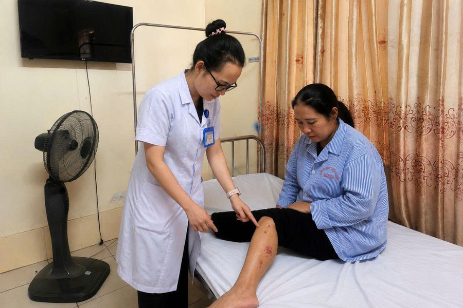 Zona thần kinh - điều trị đúng, giảm nguy cơ biến chứng