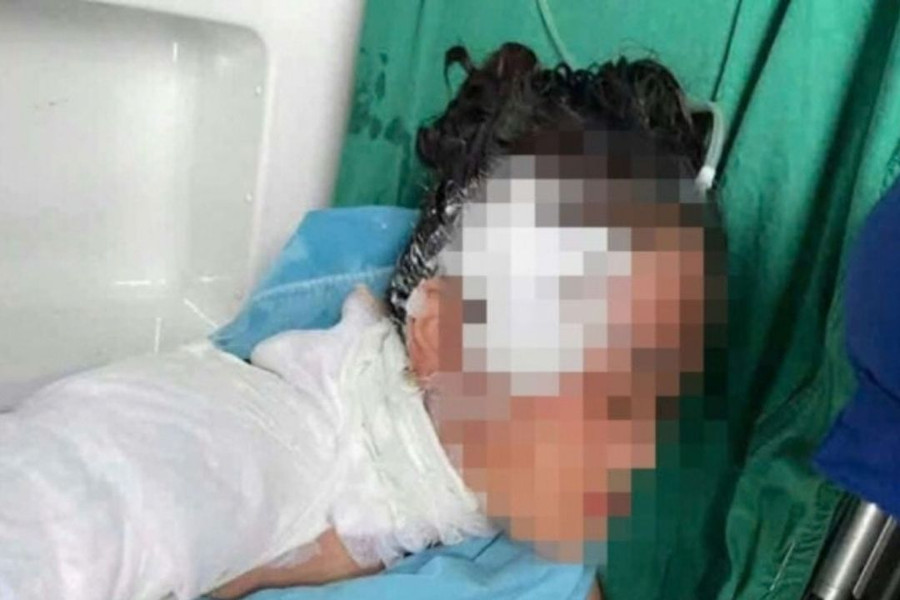Người phụ nữ ở Nghệ An bị sét đánh trúng hiện sức khỏe giờ ra sao?